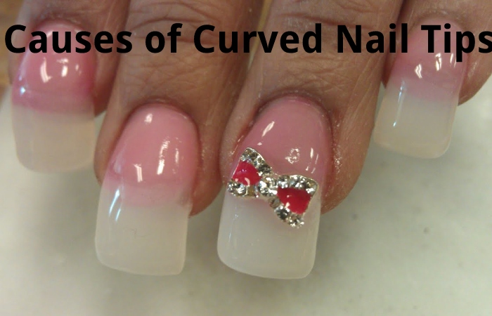 Causes of Curved Nail Tips