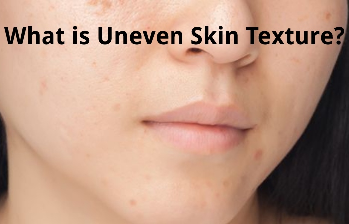 What is Uneven Skin Texture?