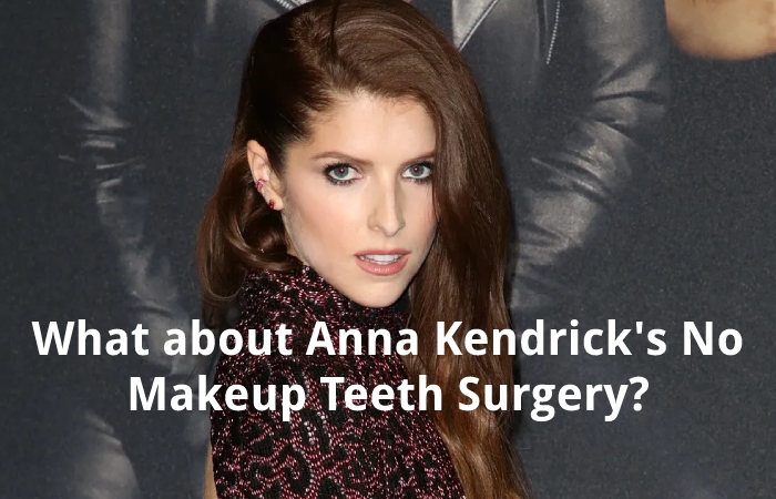 What about Anna Kendrick's No Makeup Teeth Surgery?